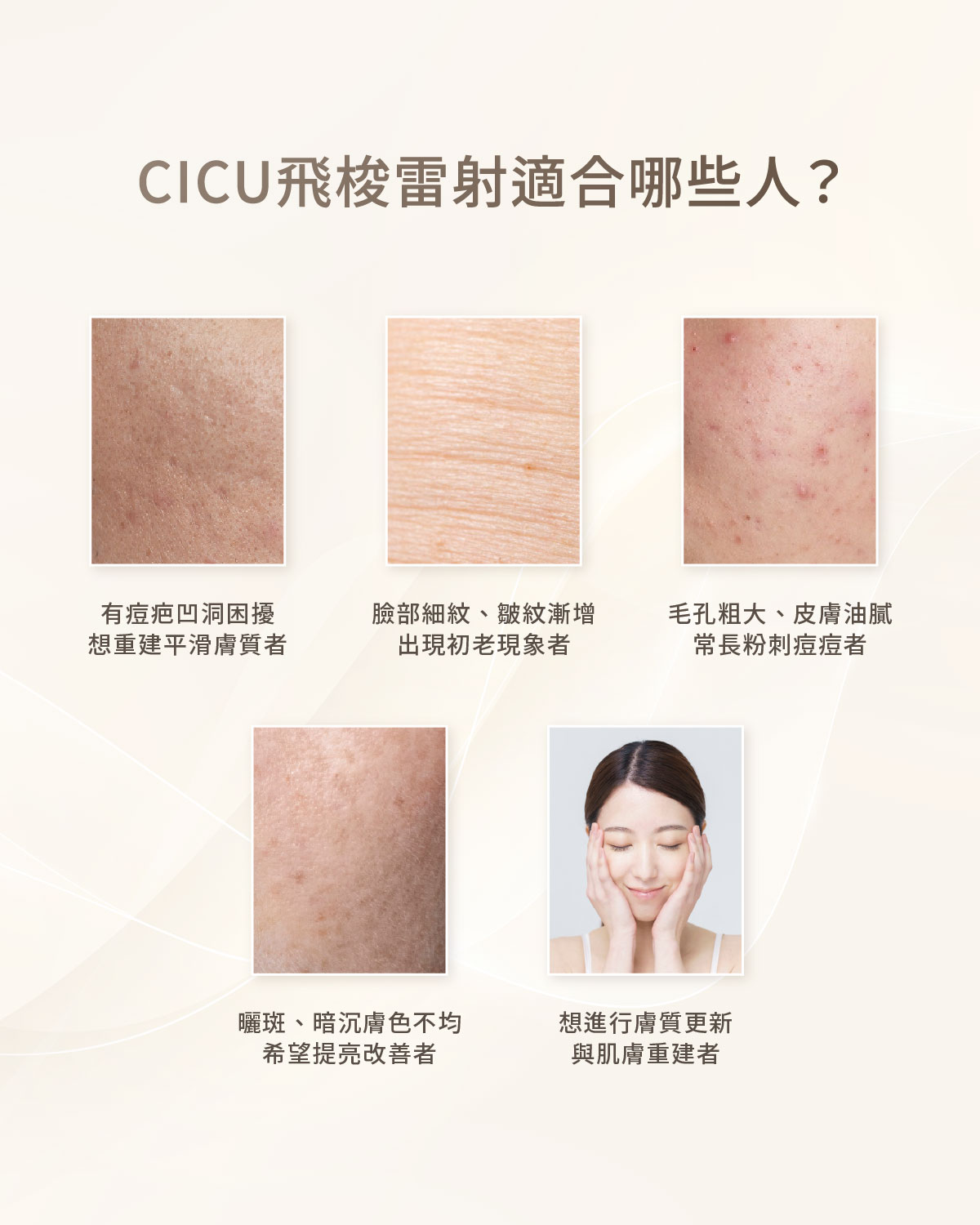 CICU飛梭雷射-適合哪些人