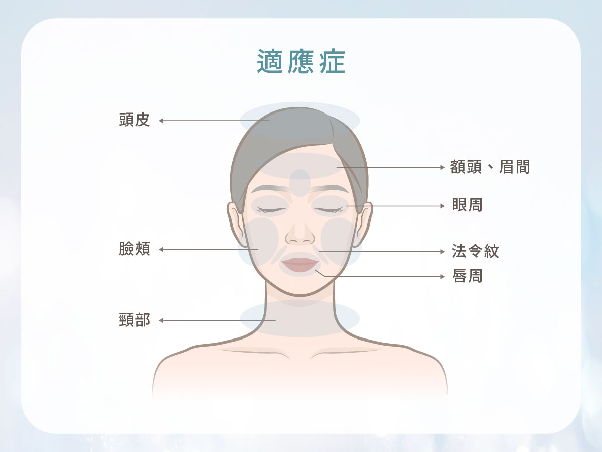 海庫斯水光槍-適應部位